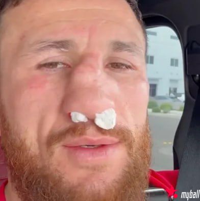 梅拉布·德瓦利什维利鼻骨两处骨折仍要打!放话硬刚亨利·塞胡多,大发体育助力你的致富之路! 梅拉布·德瓦利什维利鼻骨两处骨折仍要打!放话硬刚亨利·塞胡多,大发体育助力你的致富之路!